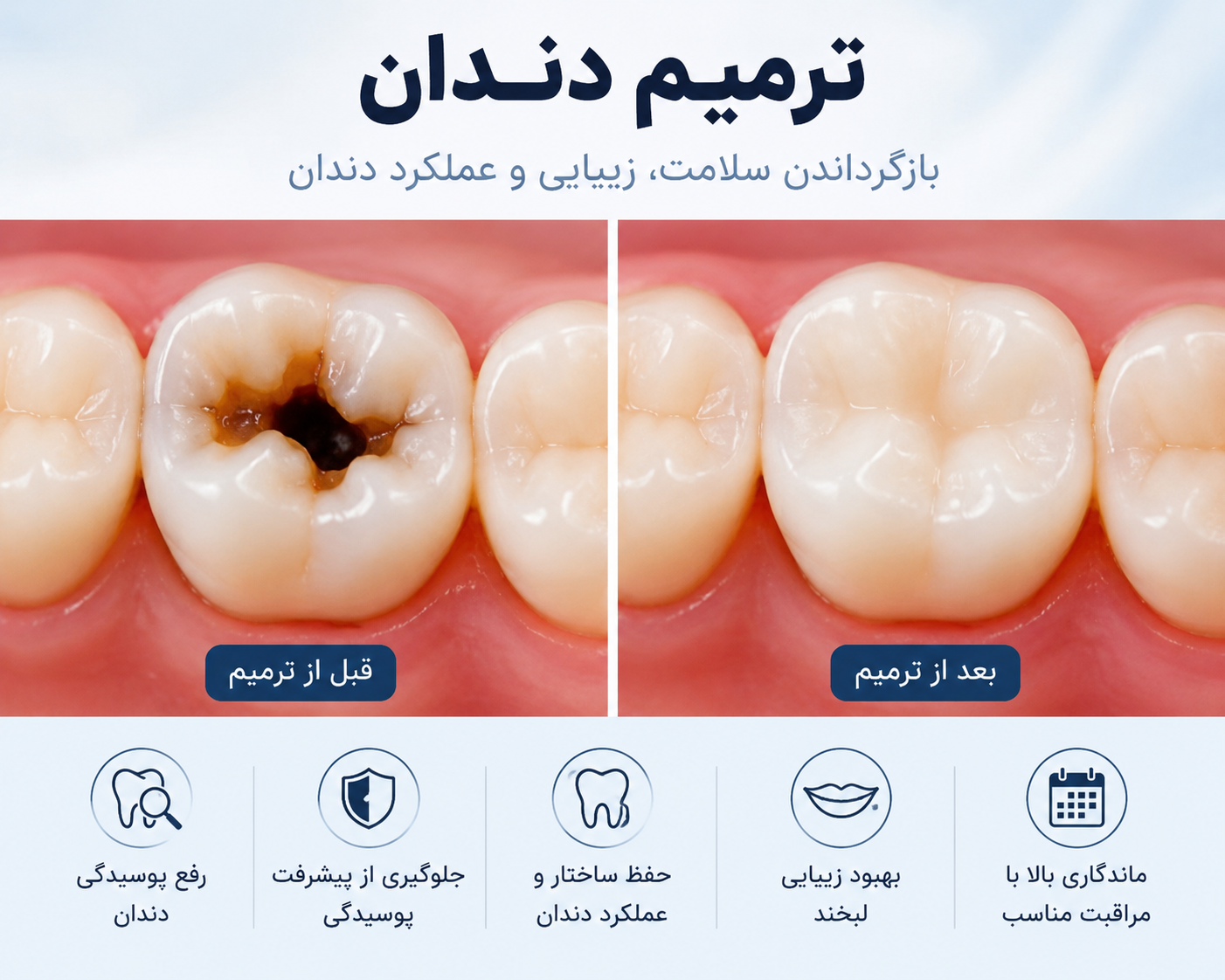 ترمیم دندان چیست؟ انواع روش‌های ترمیم و بهترین زمان مراجعه به دندانپزشک